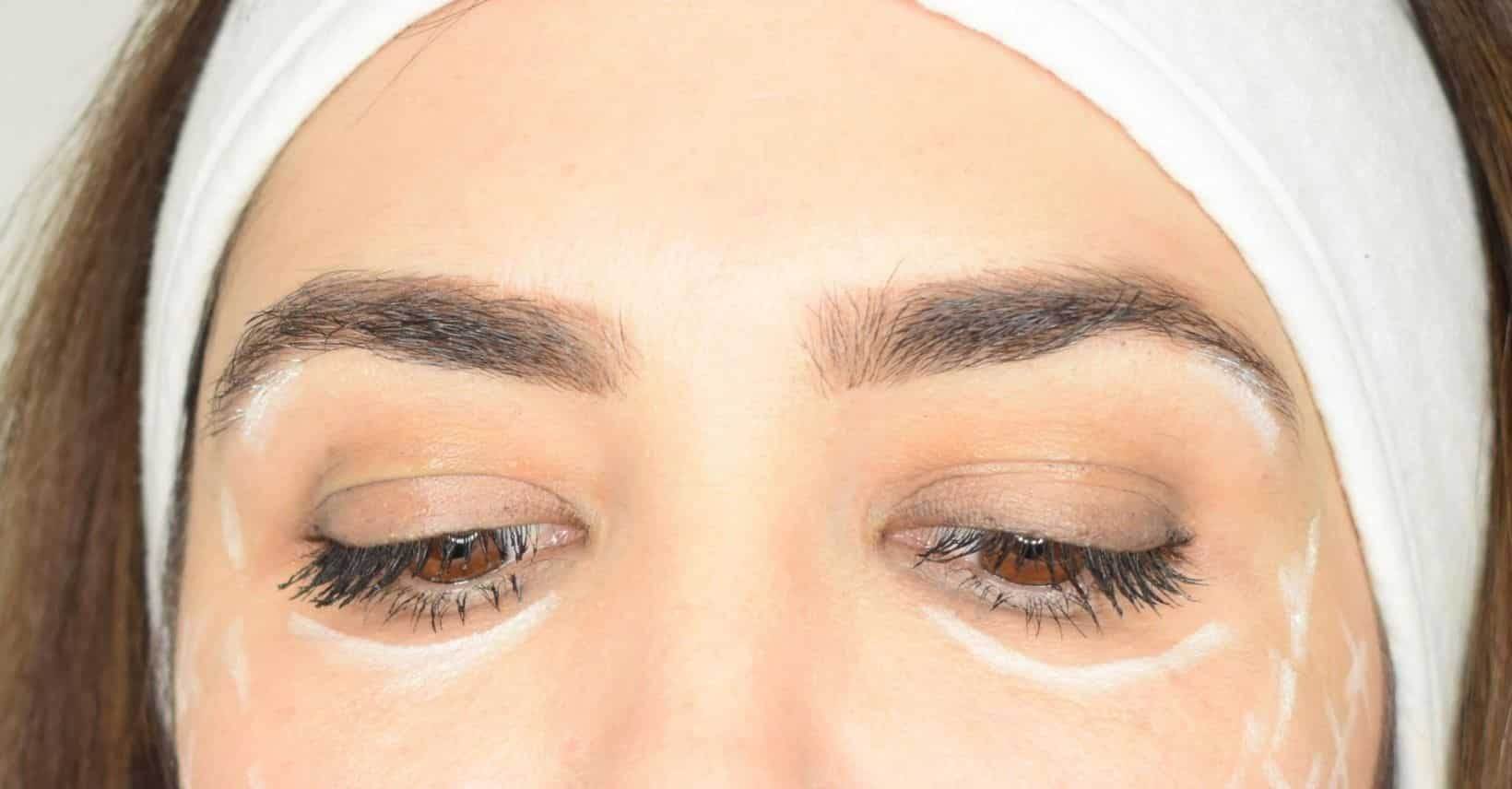 Tear trough correction Derma Institute