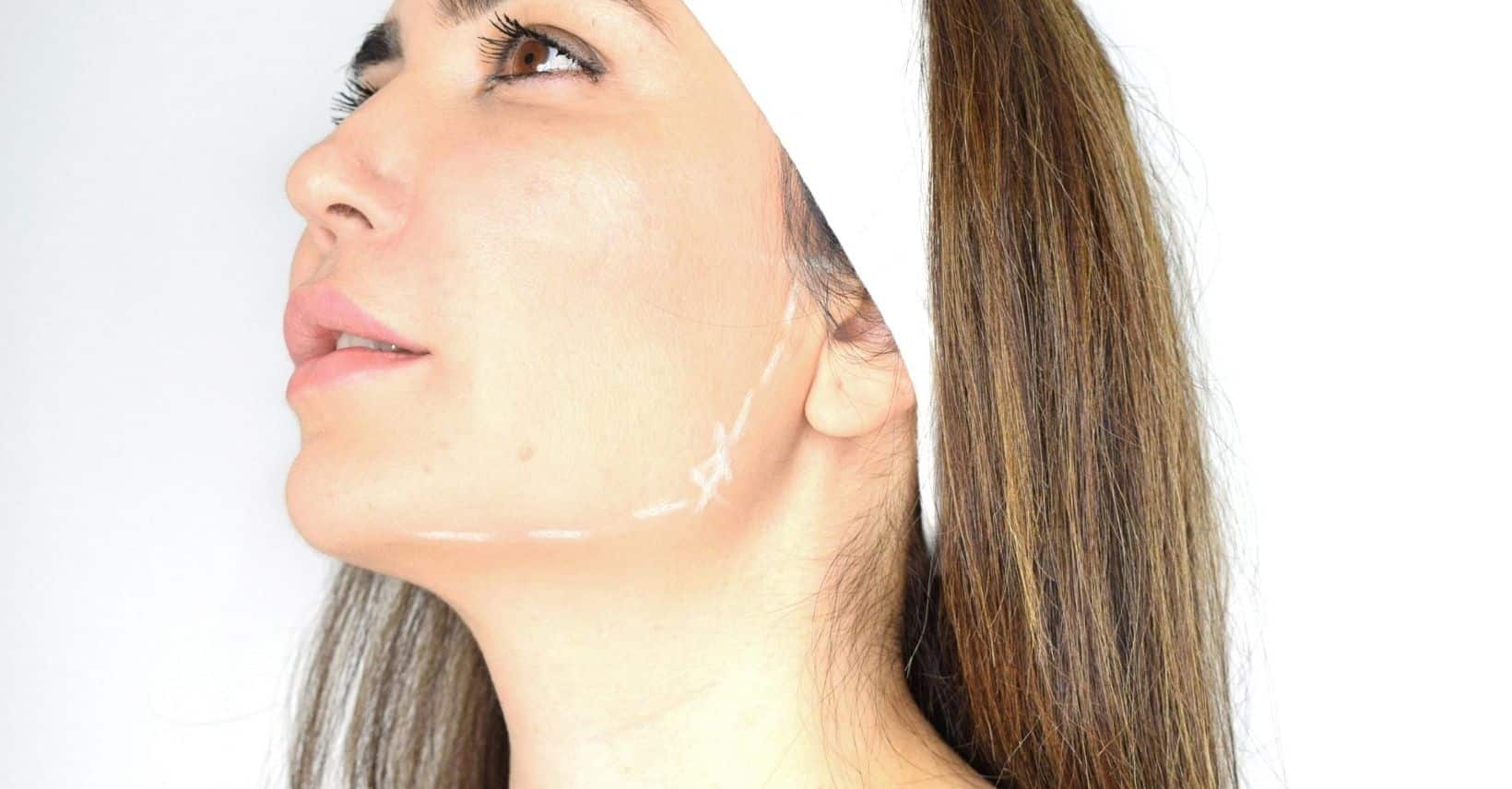 Jawline contouring Derma Institute